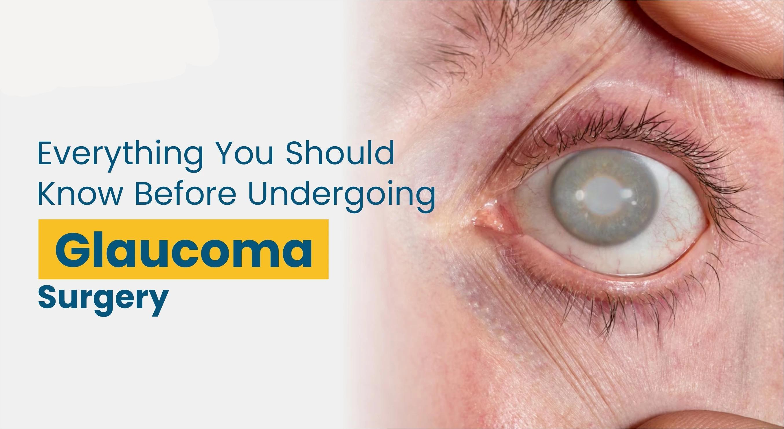 Glaucoma Treatment